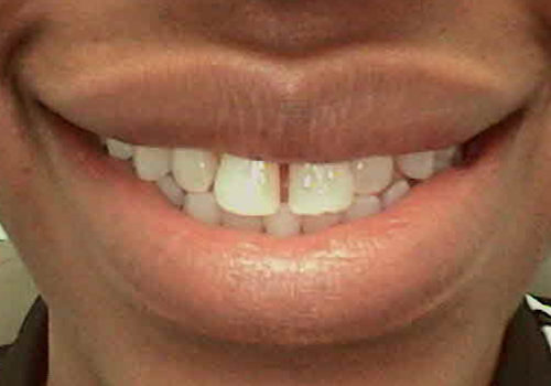 dental_checkups_Yorkville